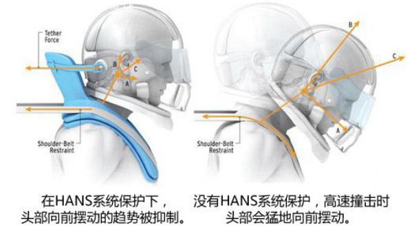 头颈保护系统HANS，固定保护（更安全）